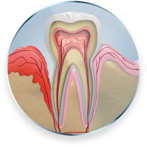 Image showing roots inside tooth