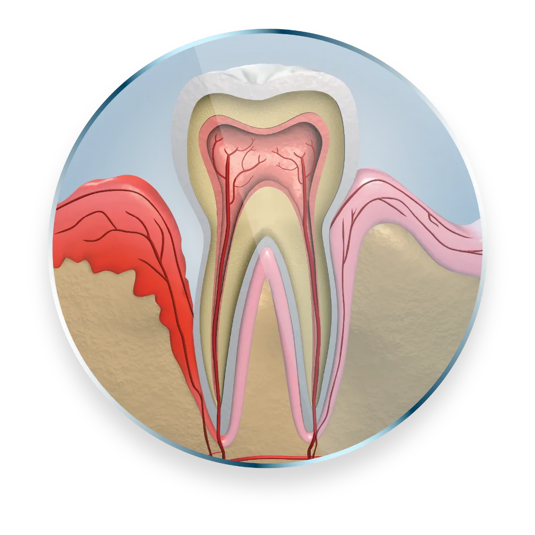 Image of roots inside of tooth